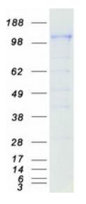 SDS-PAGE (CD163-064H).jpg